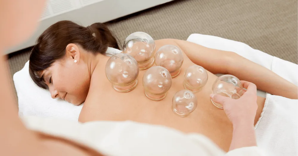 Ventouses Cupping — prochainement chez Elite Recovery